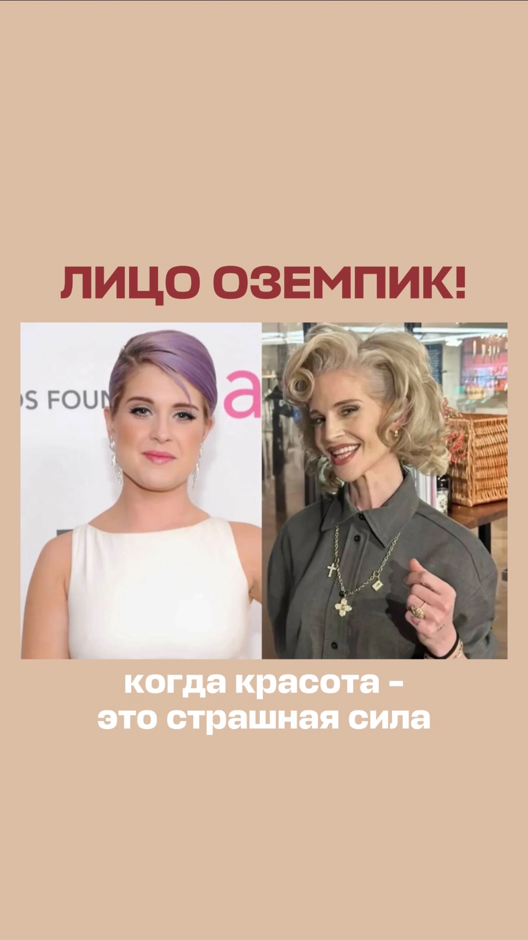 Лицо Оземпик