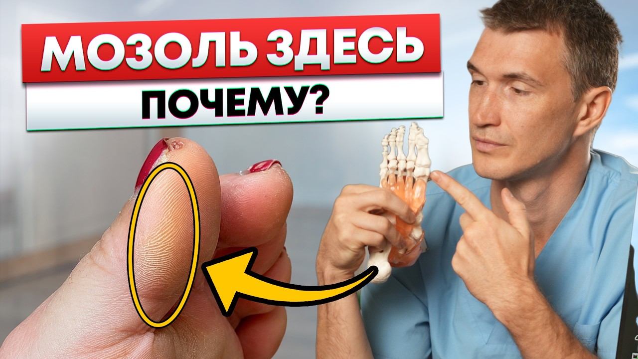 Скрытая угроза в ваших стопах: почему вы стареете быстрее из-за походки