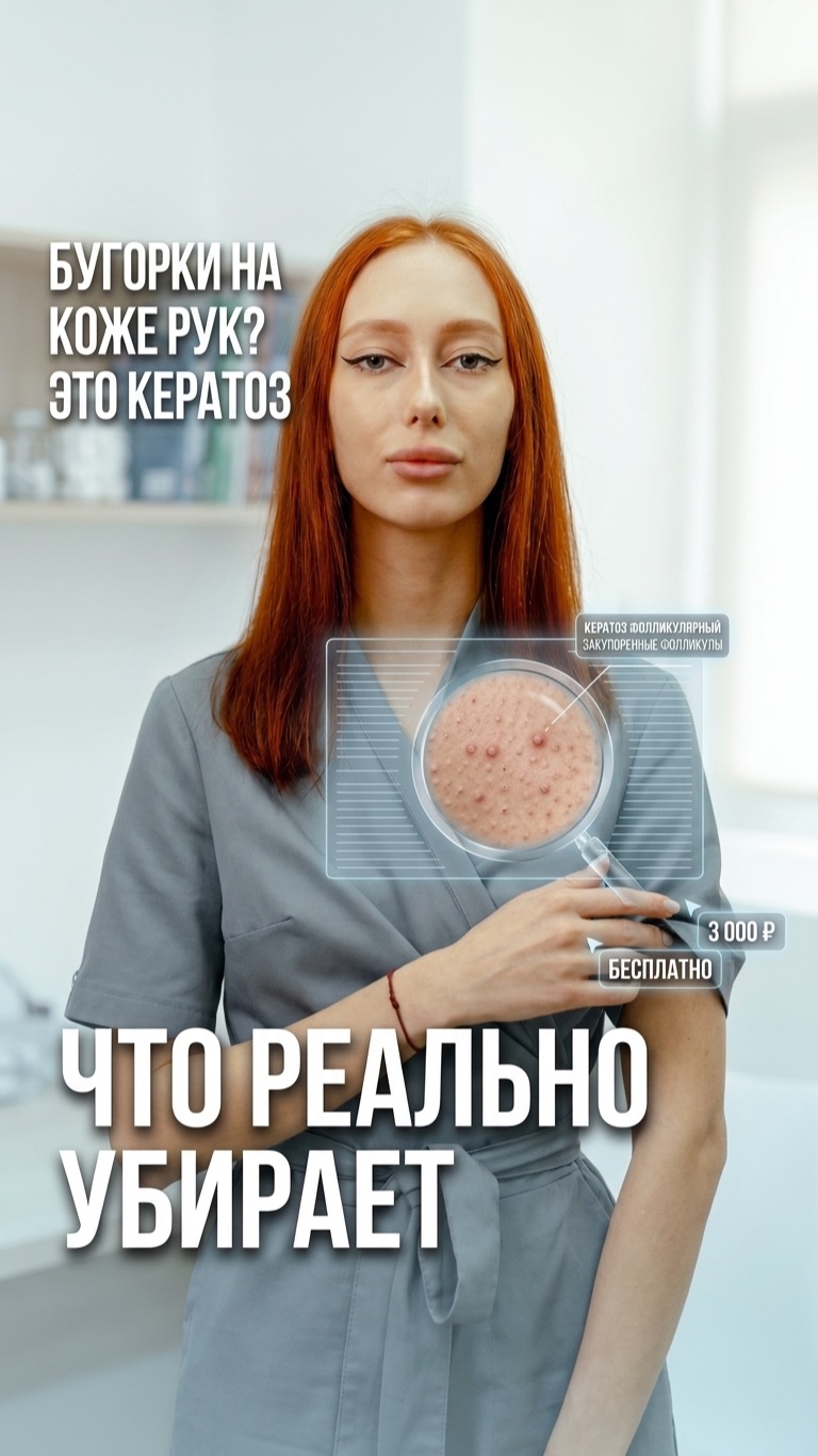 Гусиная кожа на руках 🙋♀️ это не грязь