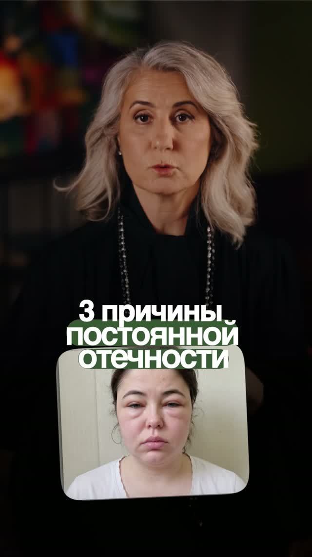 ГЛАВНЫЕ ПРИЧИНЫ ОТЕКОВ! #отеки #вода #здоровье