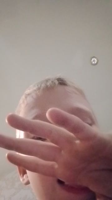 это я показываю свою рану
