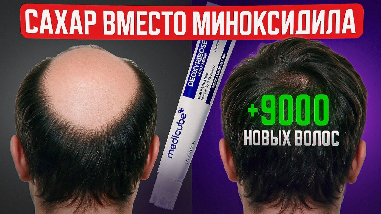 Новое средство от облысения_ дезоксирибоза — что мы знаем в 2026 году