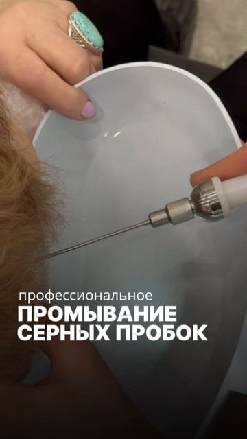 Частая причина временного снижения слуха — серная пробка.