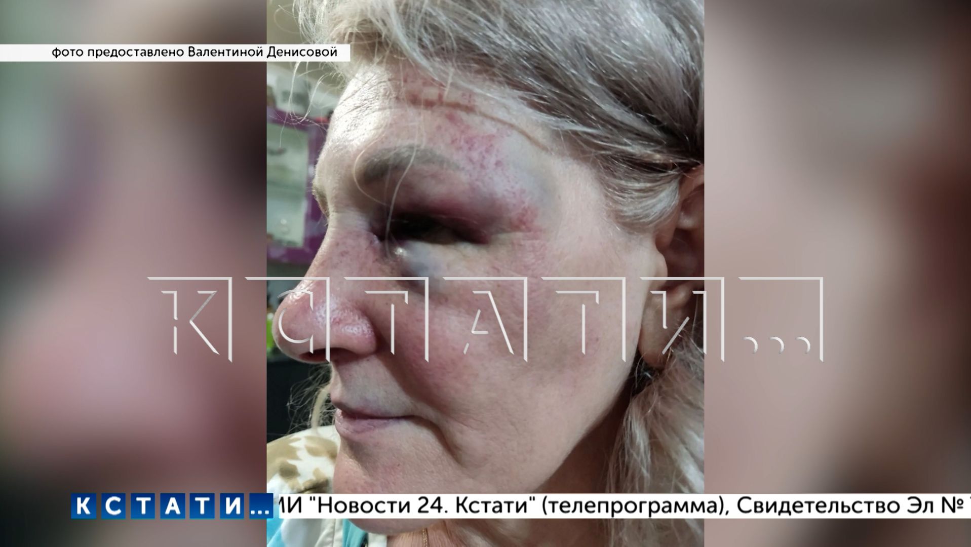 Жена, которую бросил муж ради любовницы, выдала его коллекторам, а он попытался откусить ей руку