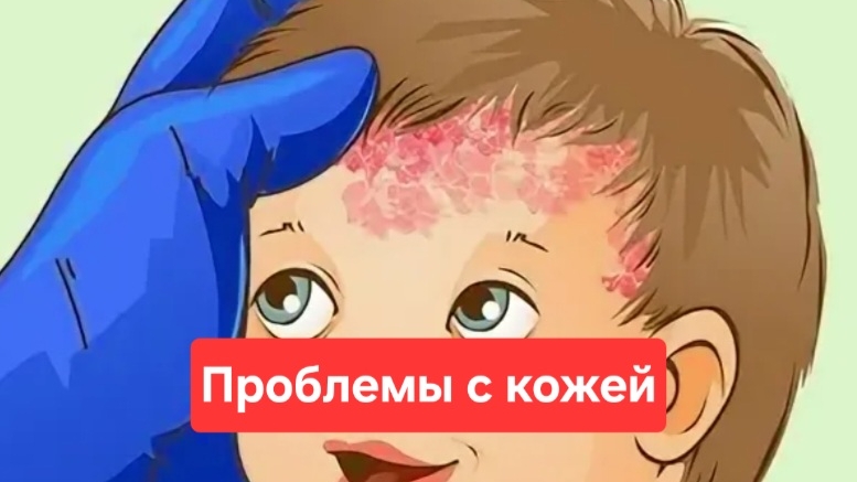 Проблемы с кожей, что делать