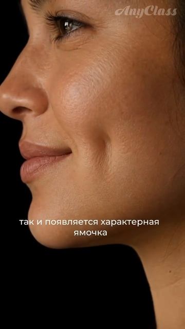 А вы знали такие подробности о милых ямочках на лице?