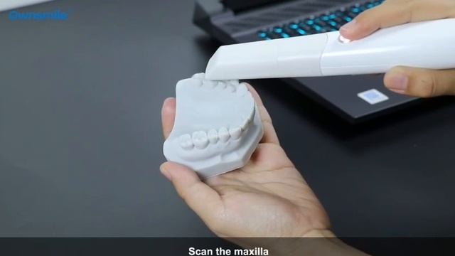 Ownsmile Oral Scanner 5S