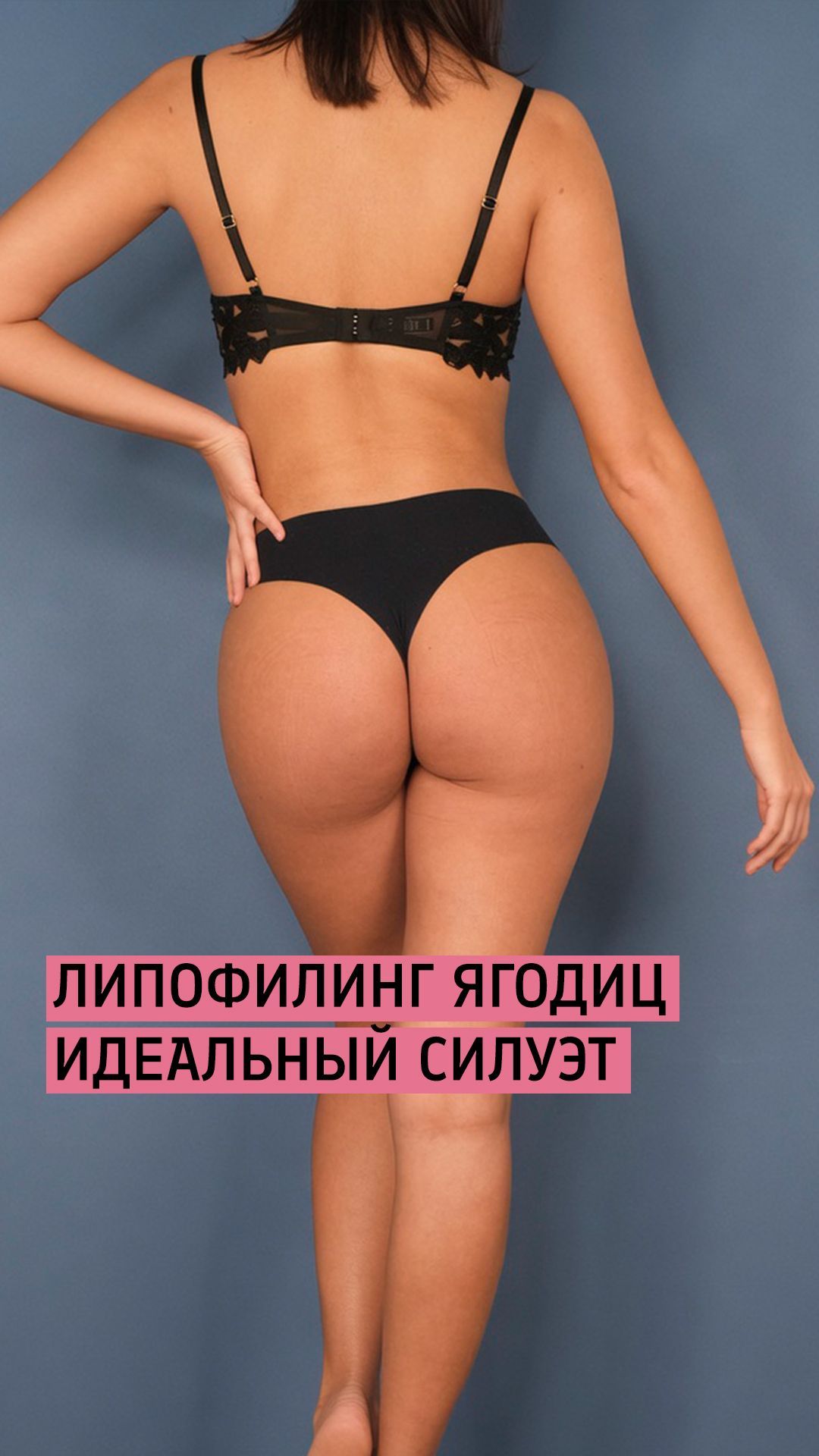 Липоскульптура - липофилинг ягодиц + липосакция / Бурлова Мария Григорьевна