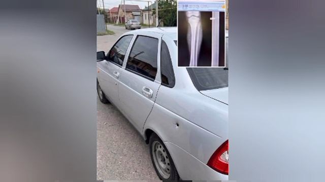 Десятилетний мальчик ранен в результате полицейской погони с стрельбой за свадебным кортежем в Ингуш
