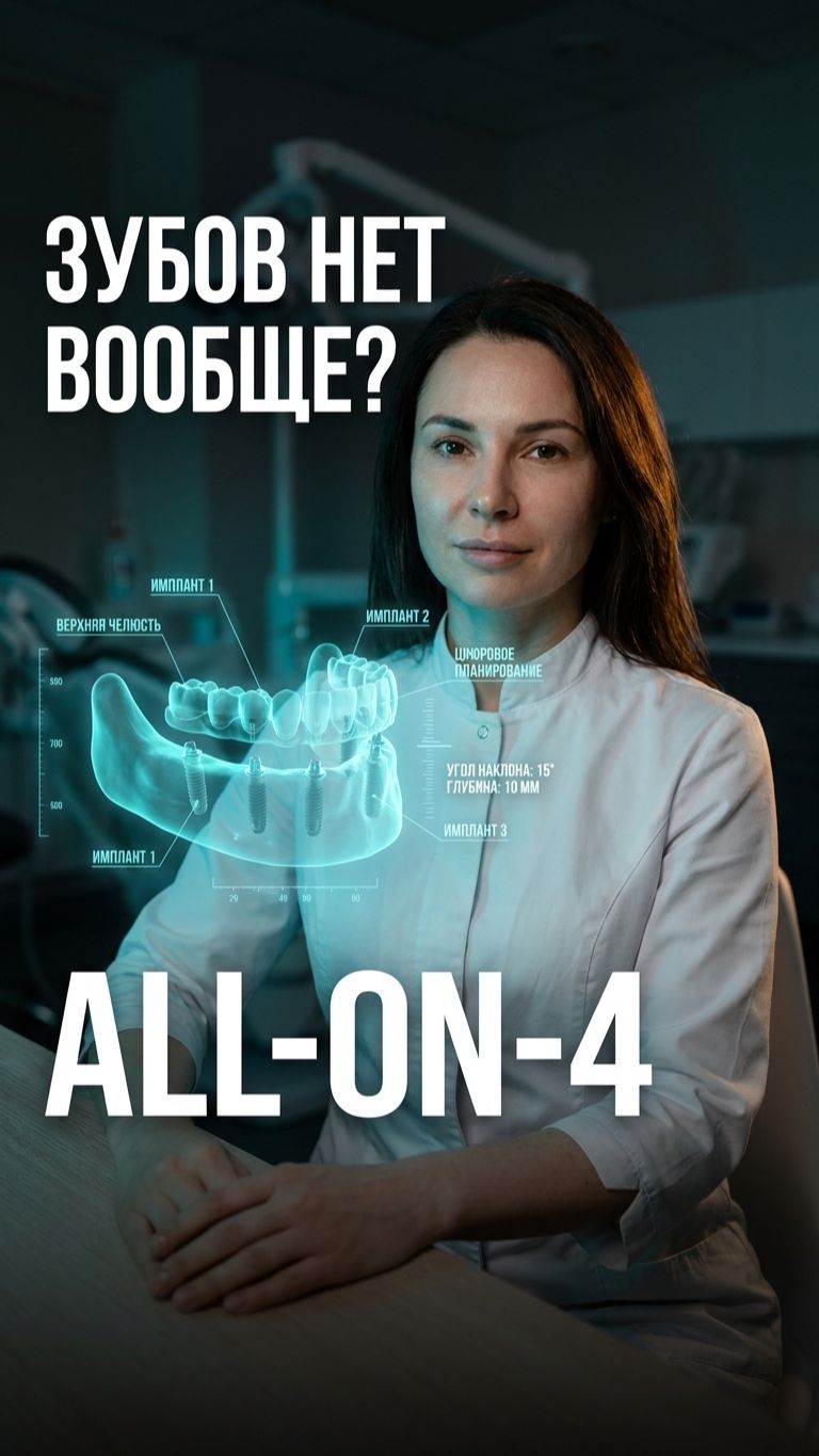 All-on-4 имплантация: что делать, если совсем нет зубов 🦷