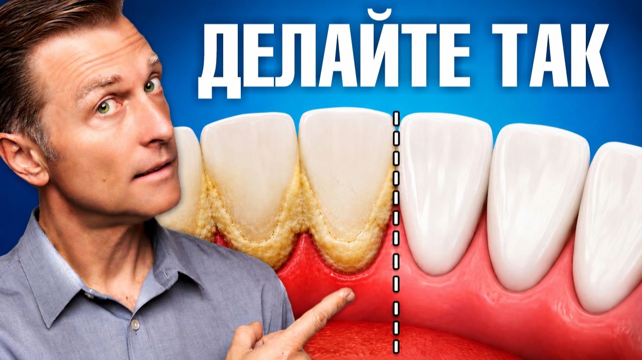 Как забыть о зубном камне навсегда: 4 простых шага