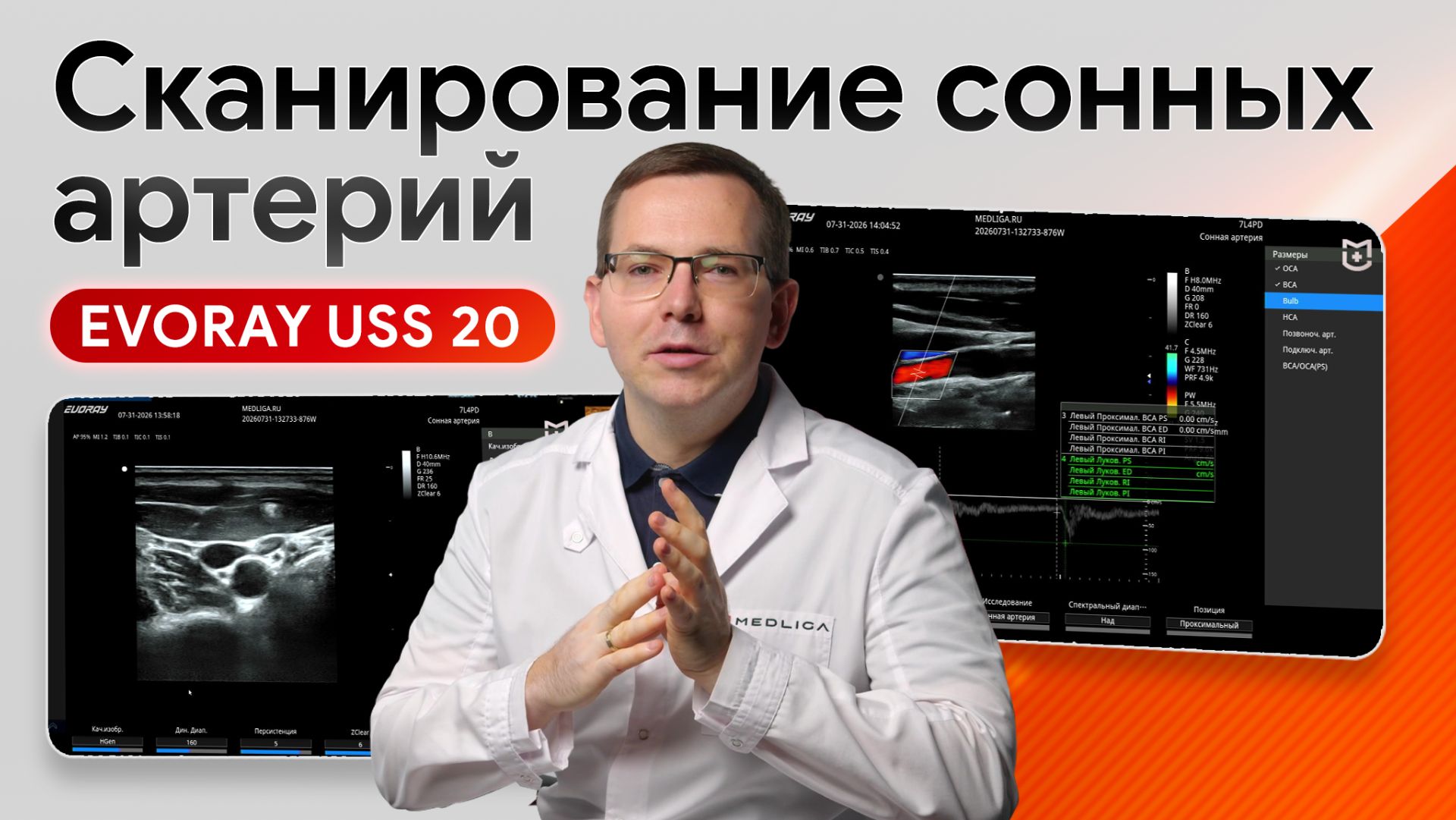 УЗИ сосудов и артерий