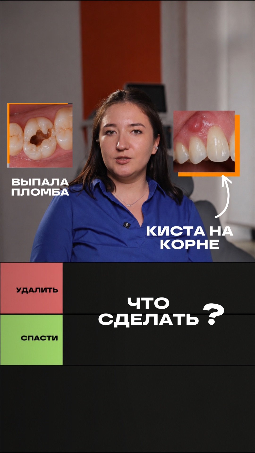 Спасти или удалить?🦷