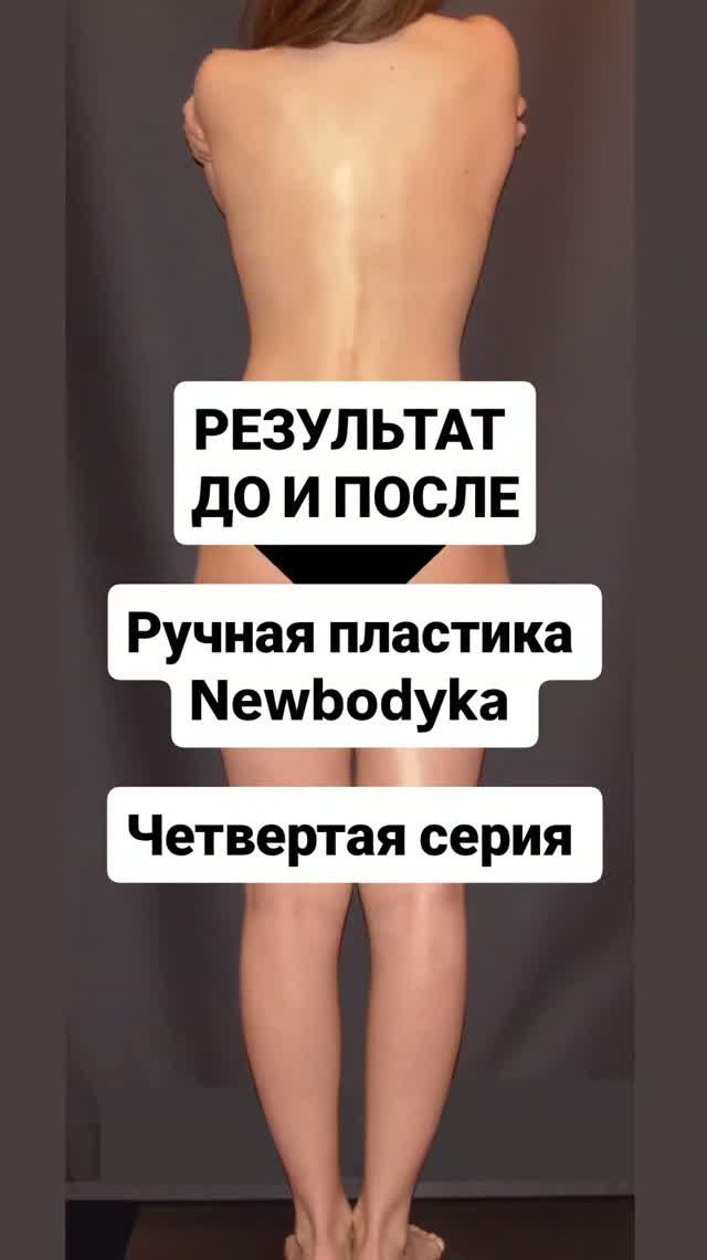 РЕЗУЛЬТАТ ДО И ПОСЛЕ. Ручная пластика тела NewBodyKa. Четвертая серия