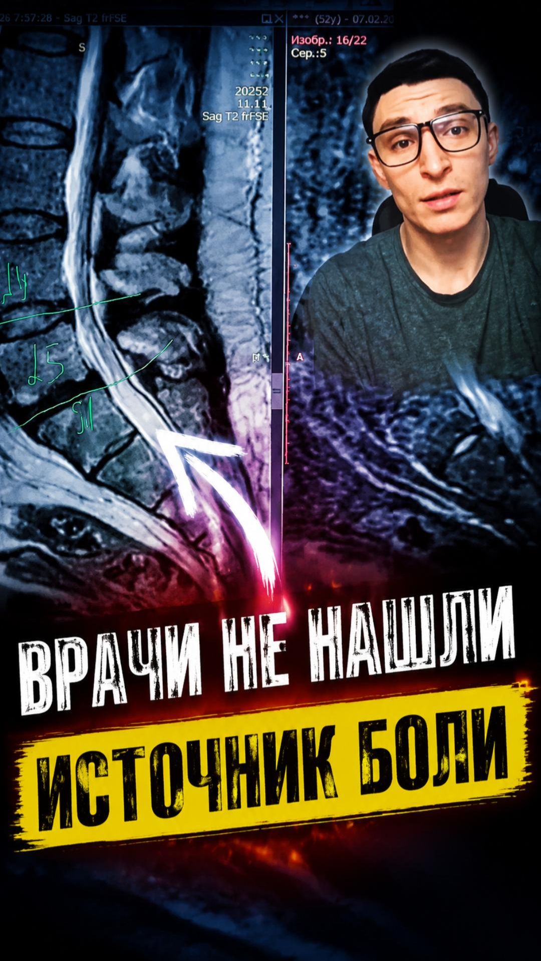 Врачи Не Нашли Источник Боли