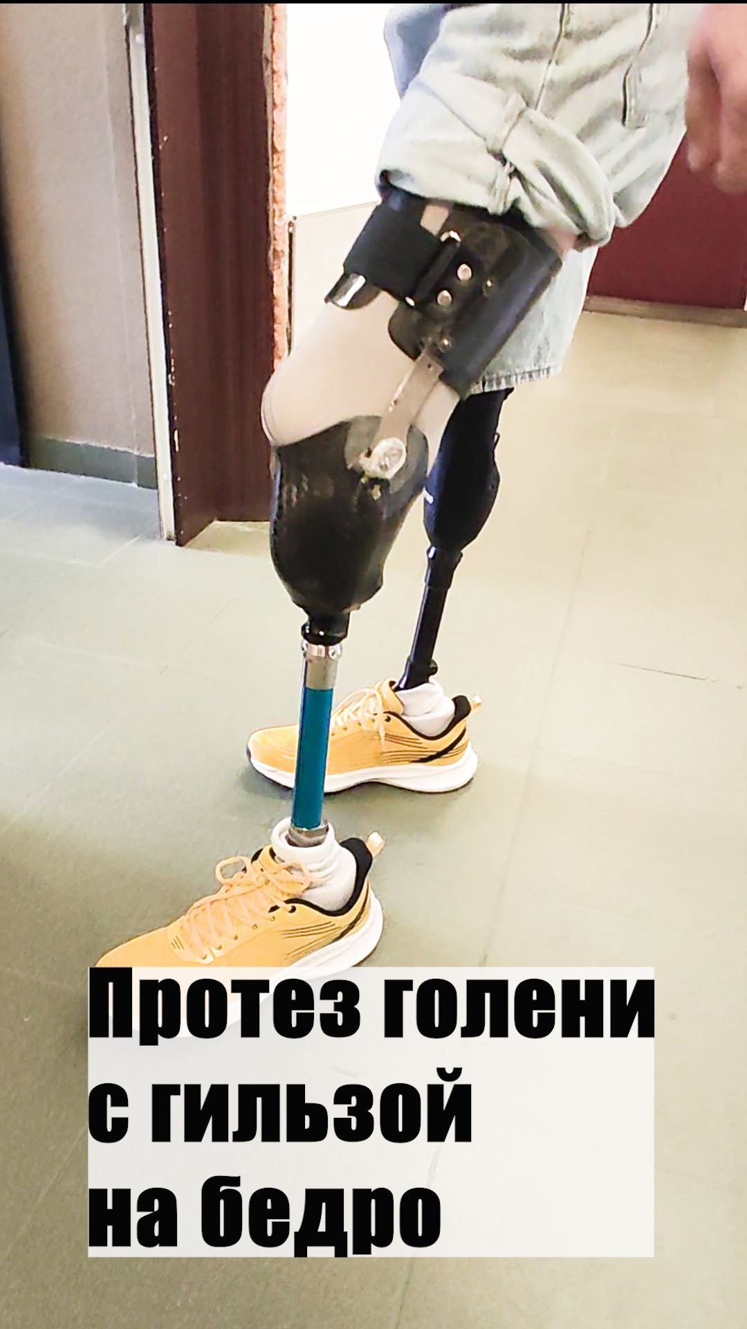 Протез голени с гильзой на бедро