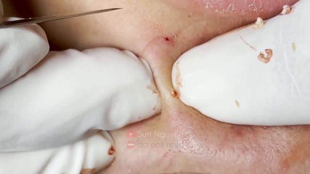 Satisfying And Relaxation With SURI NGUYEN Beauty Spa Video #365