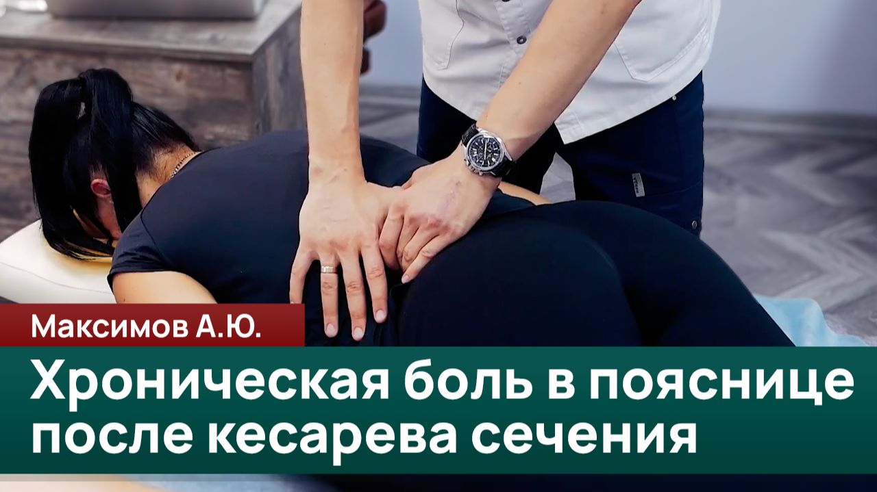 Хроническая боль в пояснице после кесарева сечения. Диагностика и лечение. Максимов А.Ю.