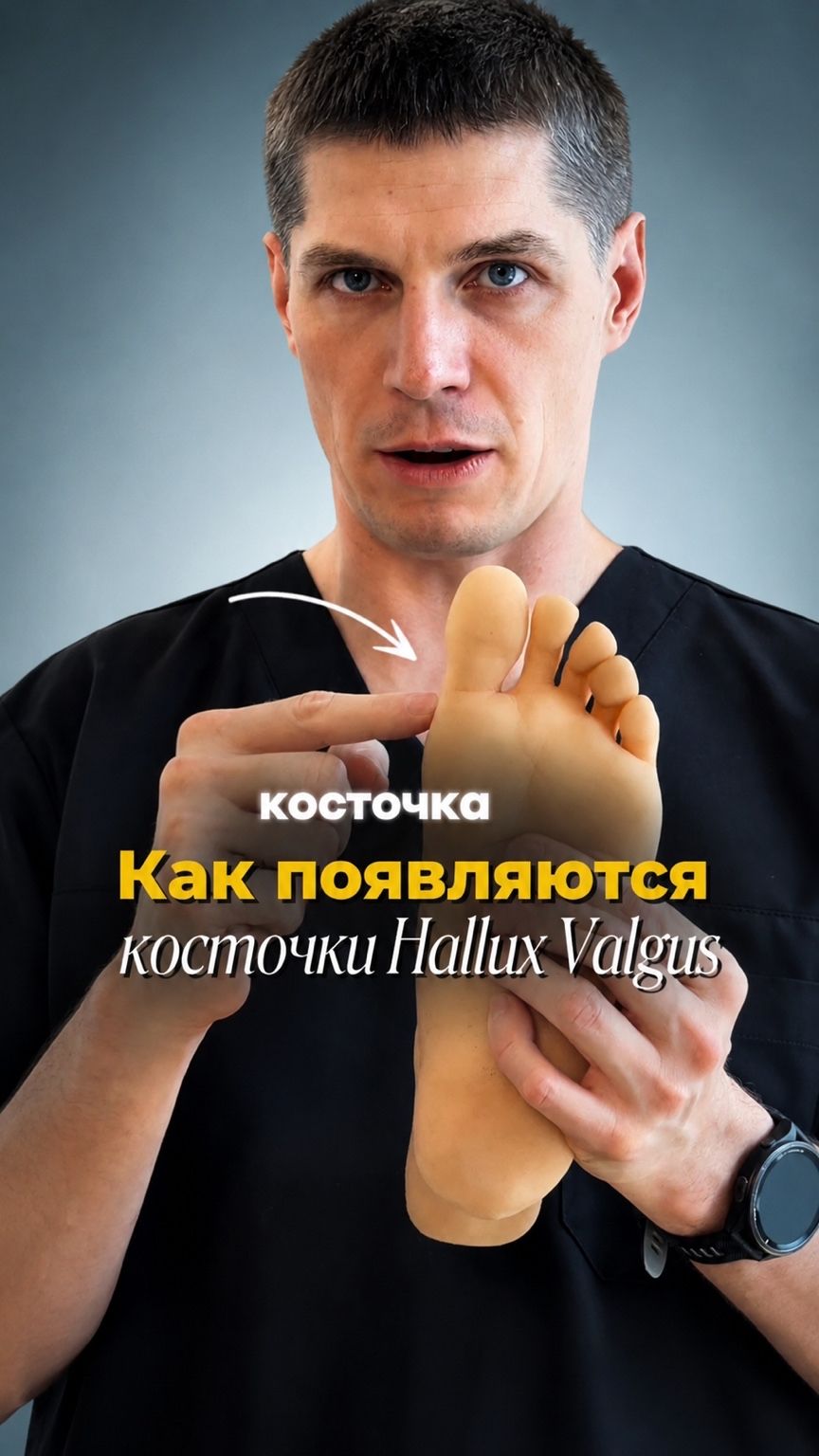Как появляются косточки Hallus Valgus?