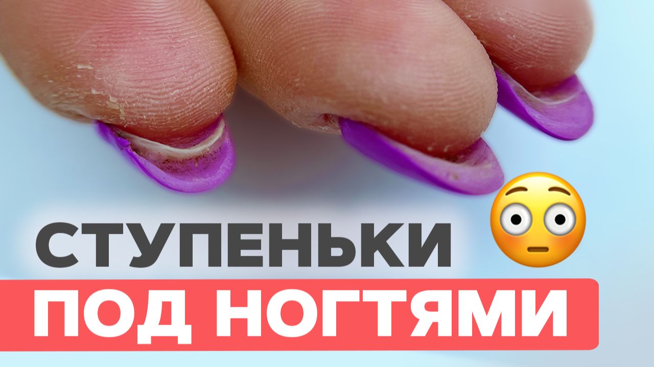 Как исправить неудачное наращивание на верхние формы? Полная коррекция