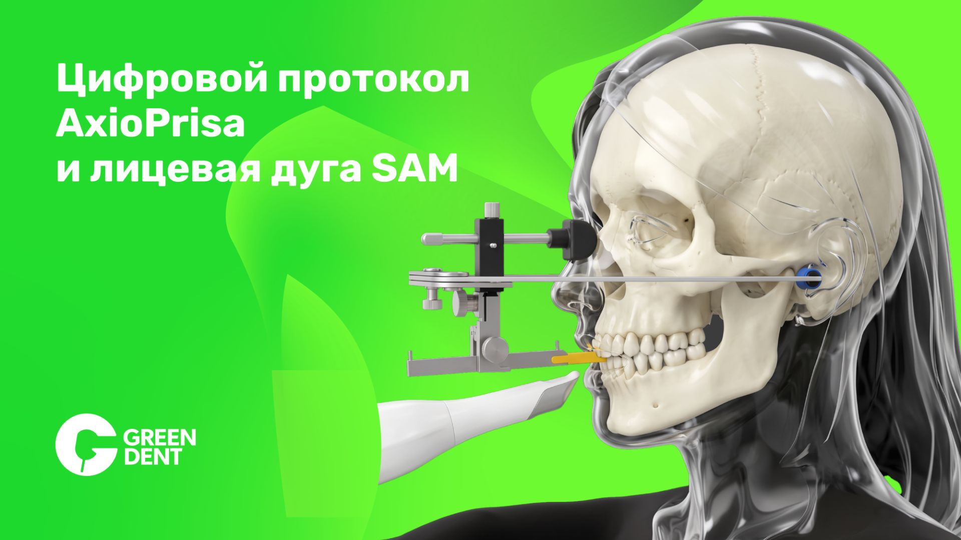 Цифровой протокол AxioPrisa и лицевая дуга SAM. Комплектация и протокол работы