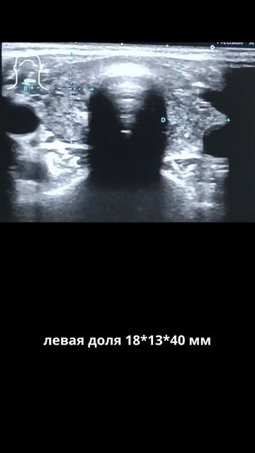 #аит