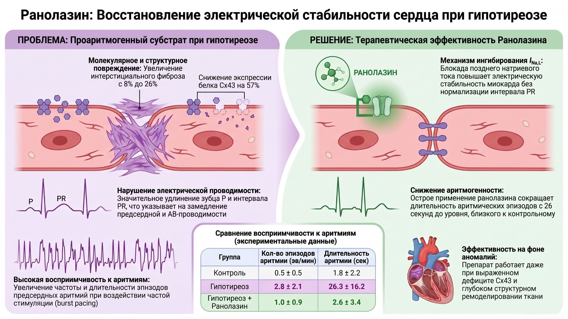 Ранолазин