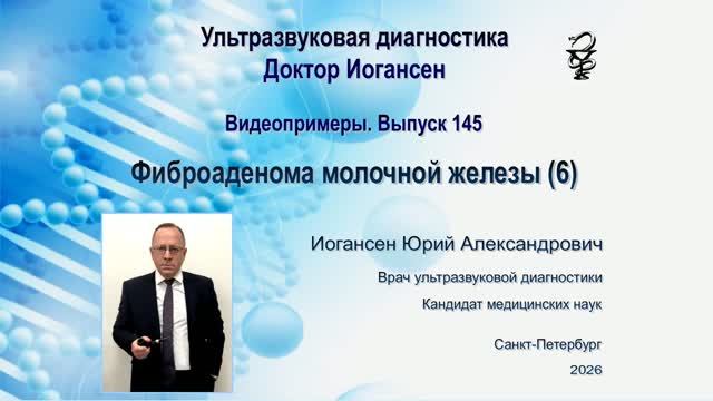 Ультразвуковая диагностика (УЗИ). Доктор Иогансен. Видеопримеры.