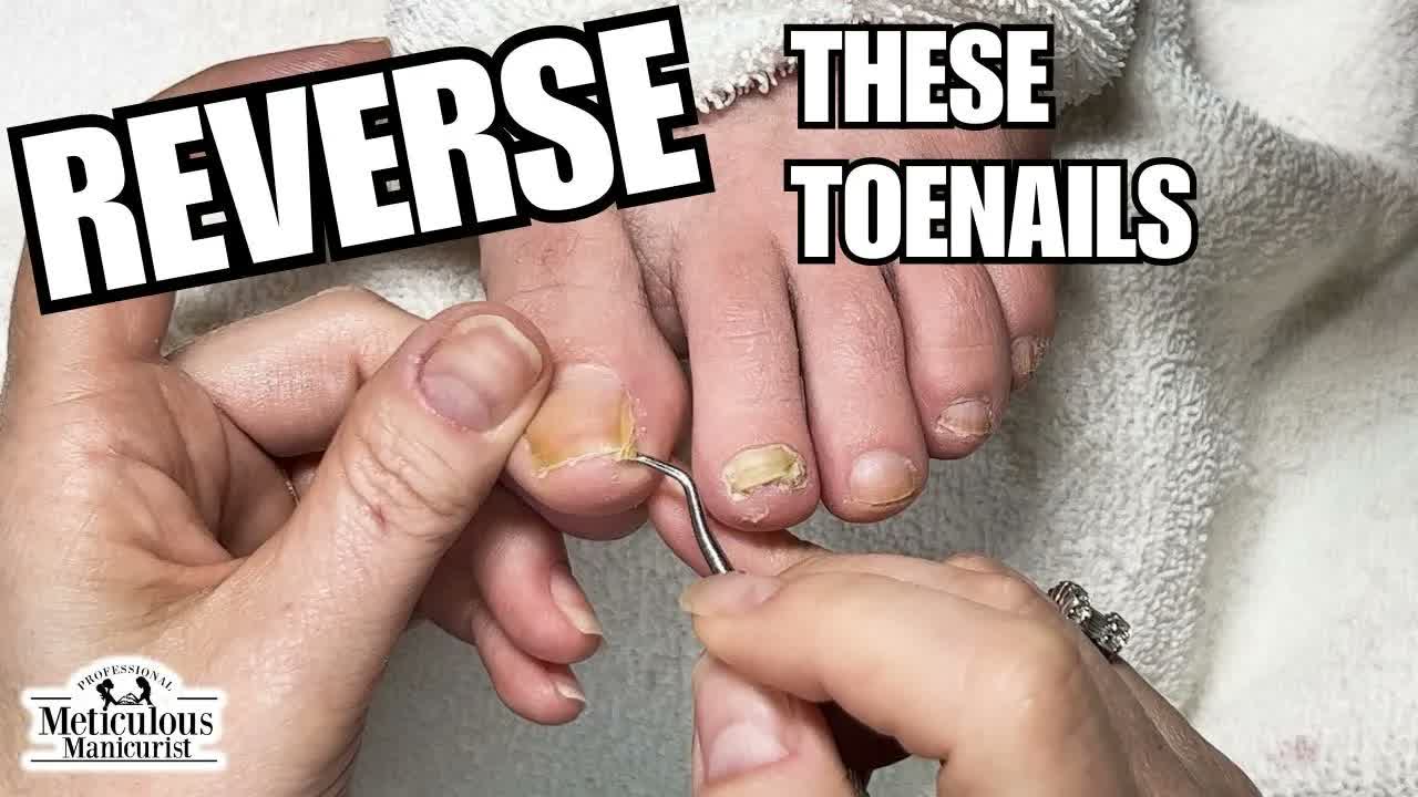 Педикюр дома: чистка ногтей #nails #satisfying