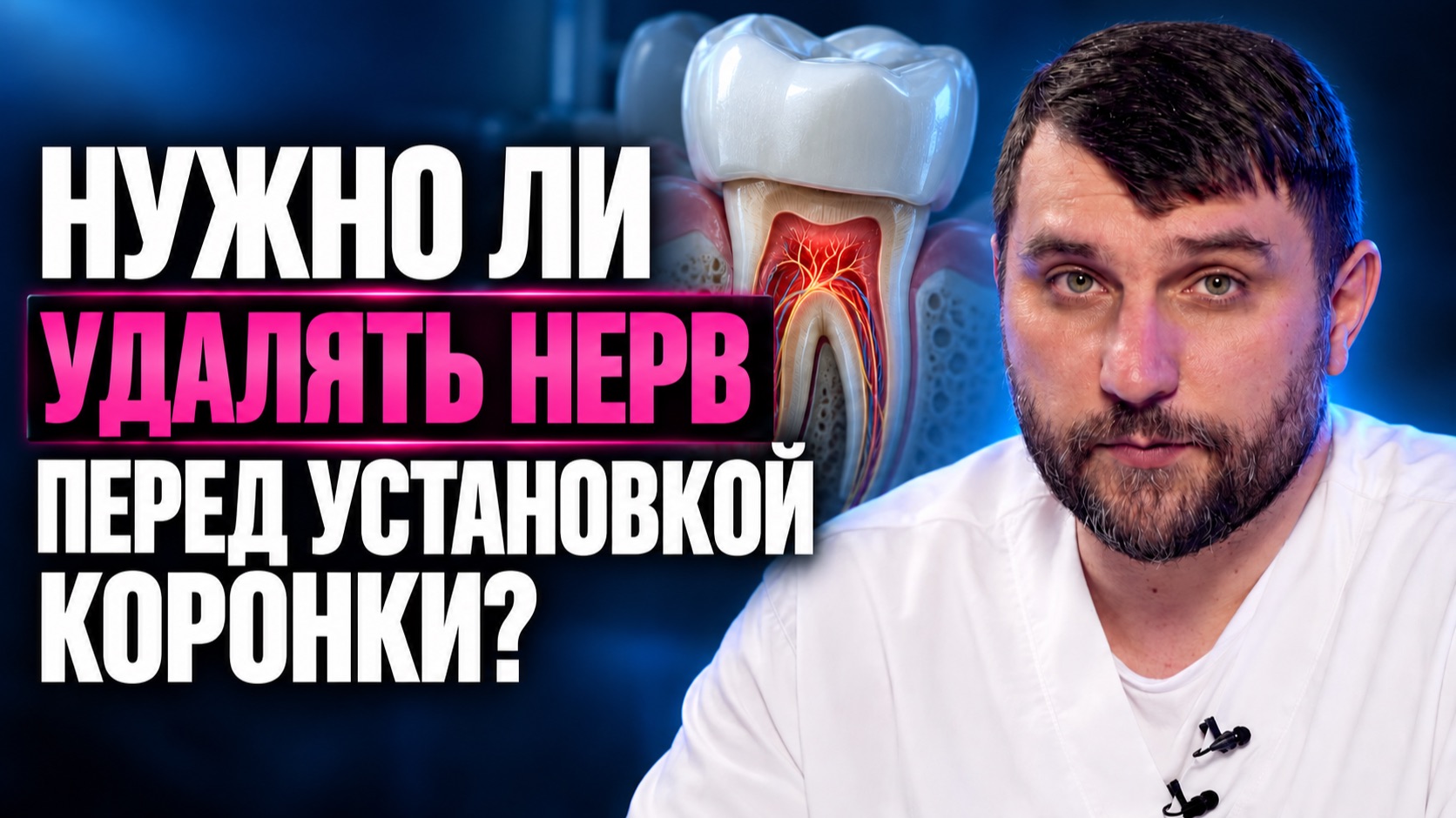 Зубные мосты
