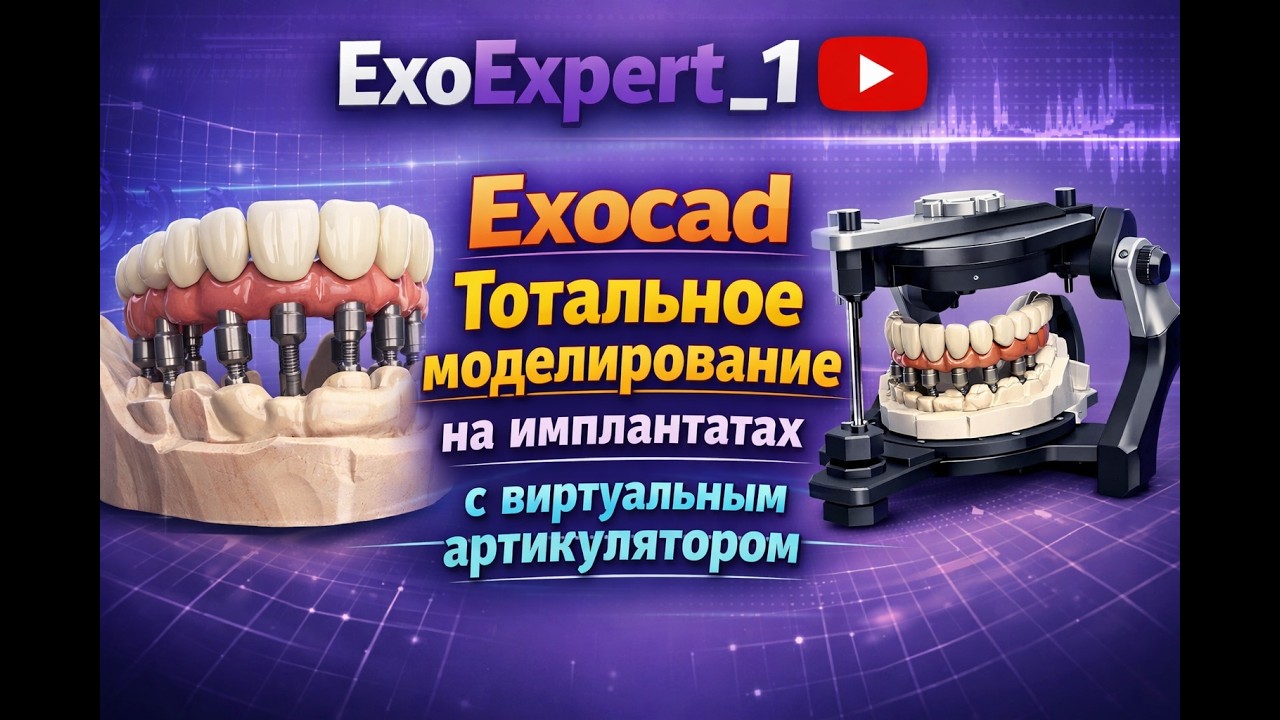 Exocad тотальное моделирование на имплантатах с виртуальным артикулятором