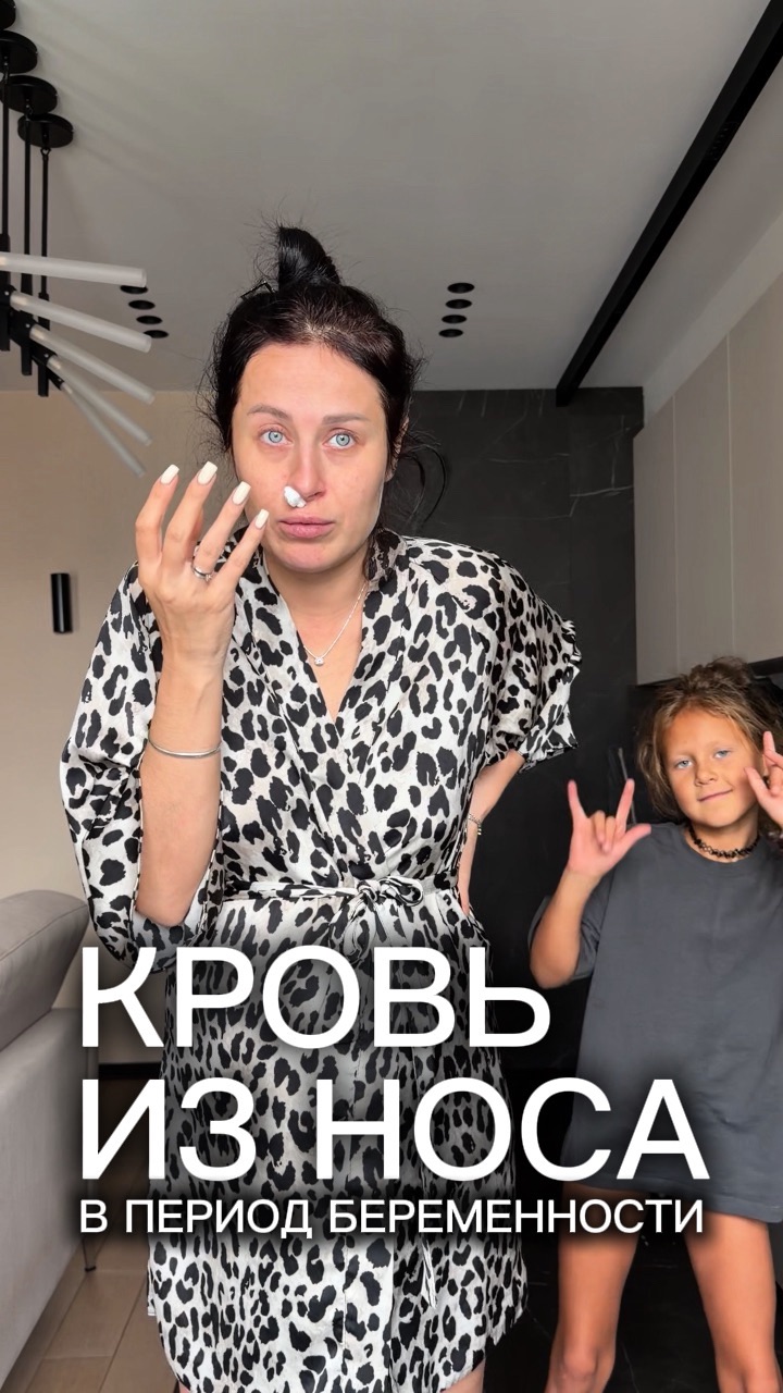 Кровь из носа