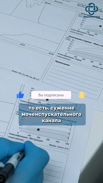 Как выглядит сужение мочеиспускательного канала у мужчин #рак #уролог #урология #простата
