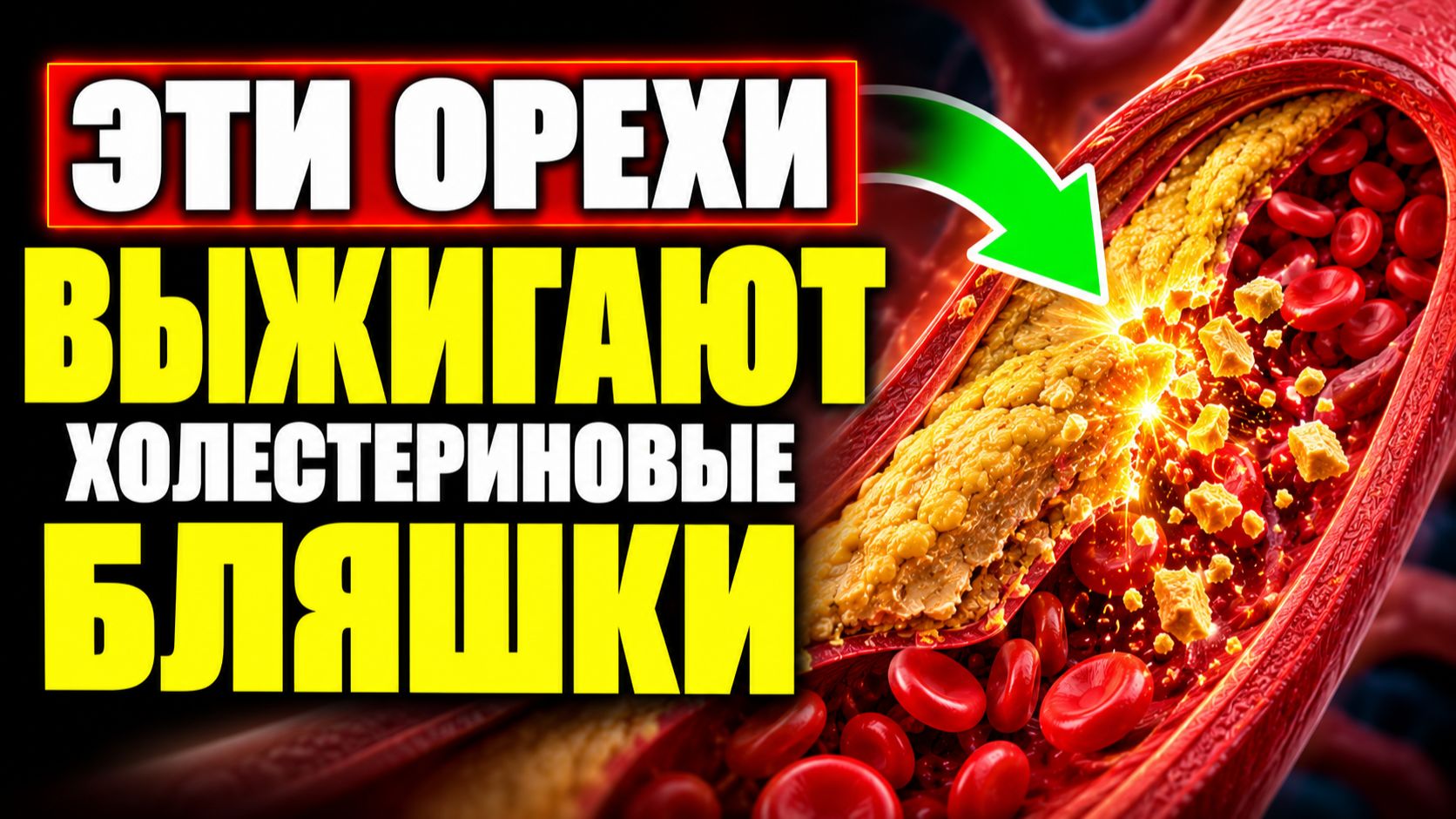 ЭТИ ОРЕХИ ВЫЖИГАЮТ ХОЛЕСТРИНОВЫЕ БЛЯШКИ
