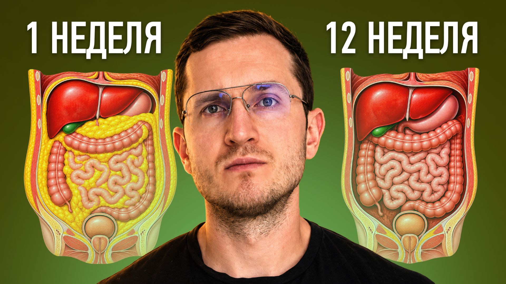 10 Минут Каждое Утро Быстро Убивают Кортизоловый Живот