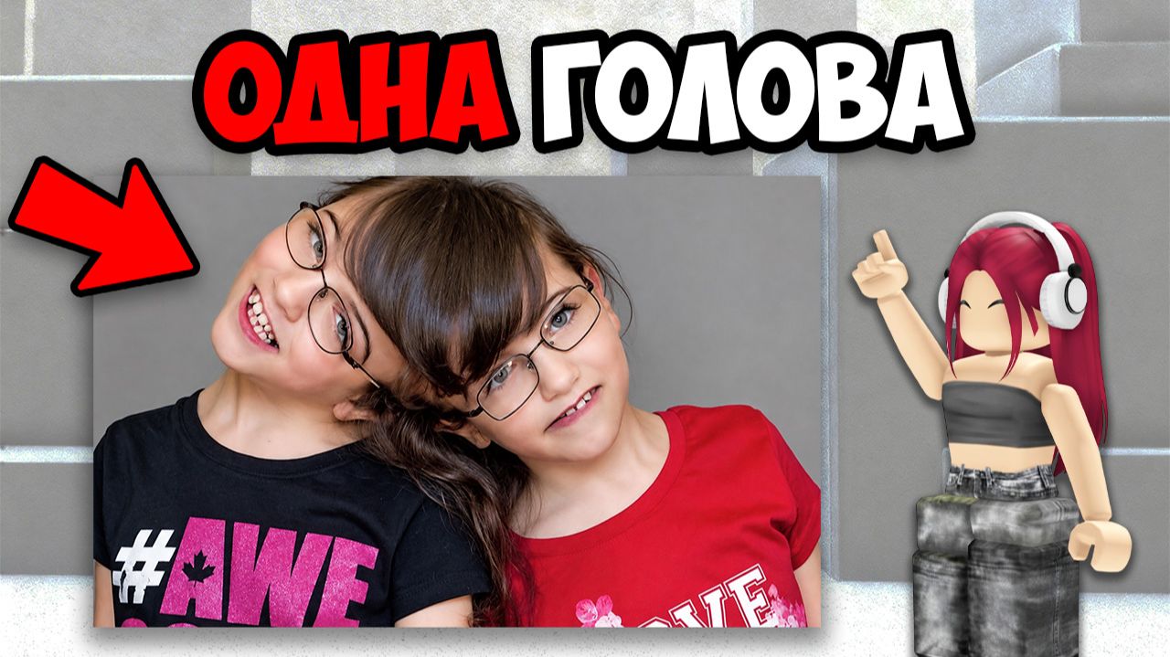 САМЫЕ НЕОБЫЧНЫЕ БЛИЗНЕЦЫ В МИРЕ