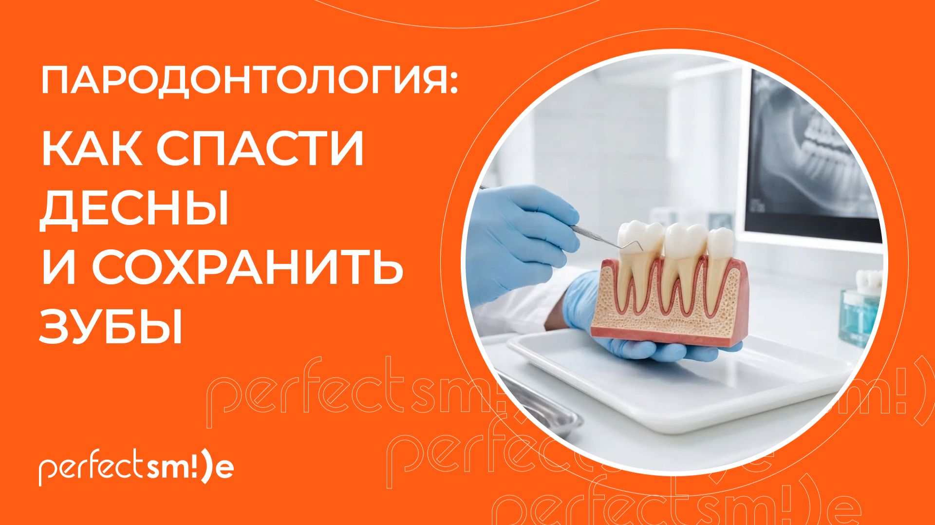 Лечение зубов