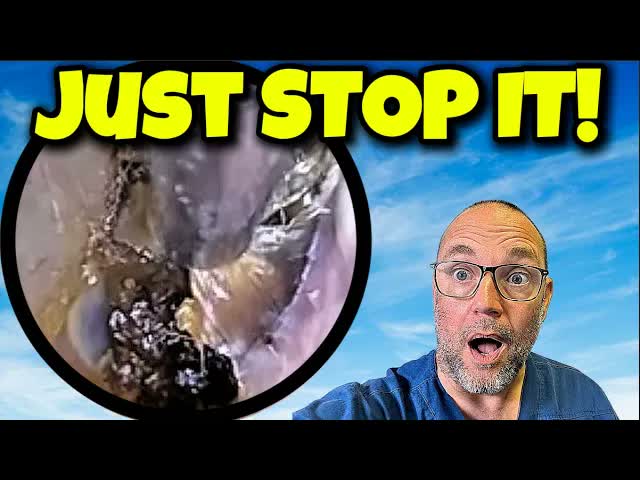 Срочно из клиники! Болезненная пробка из ватной палочки | Выпуск 684