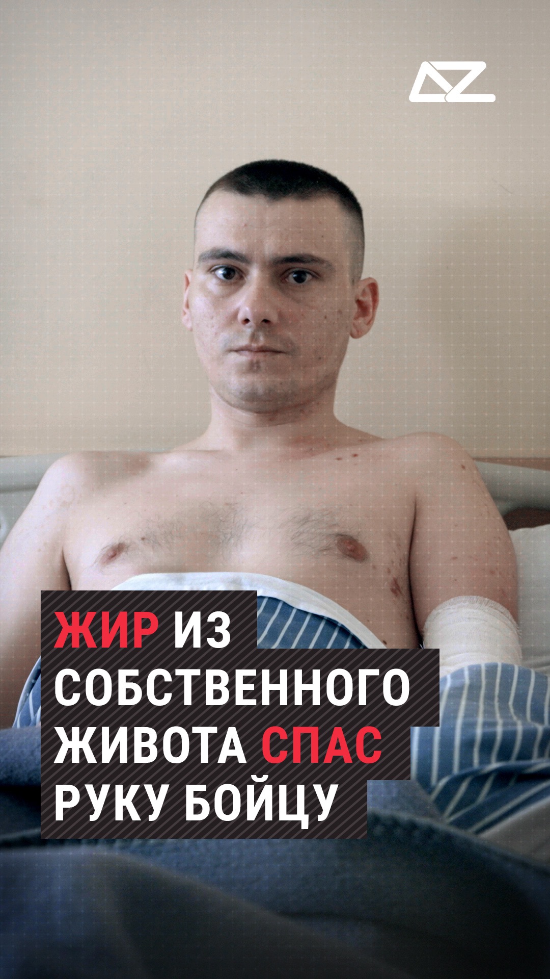 Жир из собственного живота спас руку бойцу #жир #живот #ранение #хирург #врачи #операция #госпиталь