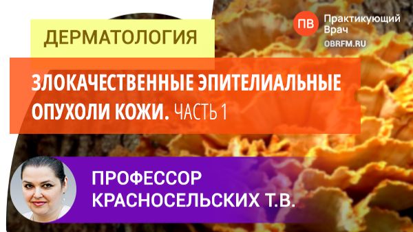 Профессор Красносельских Т.В.: Злокачественные эпителиальные опухоли кожи. Часть 1