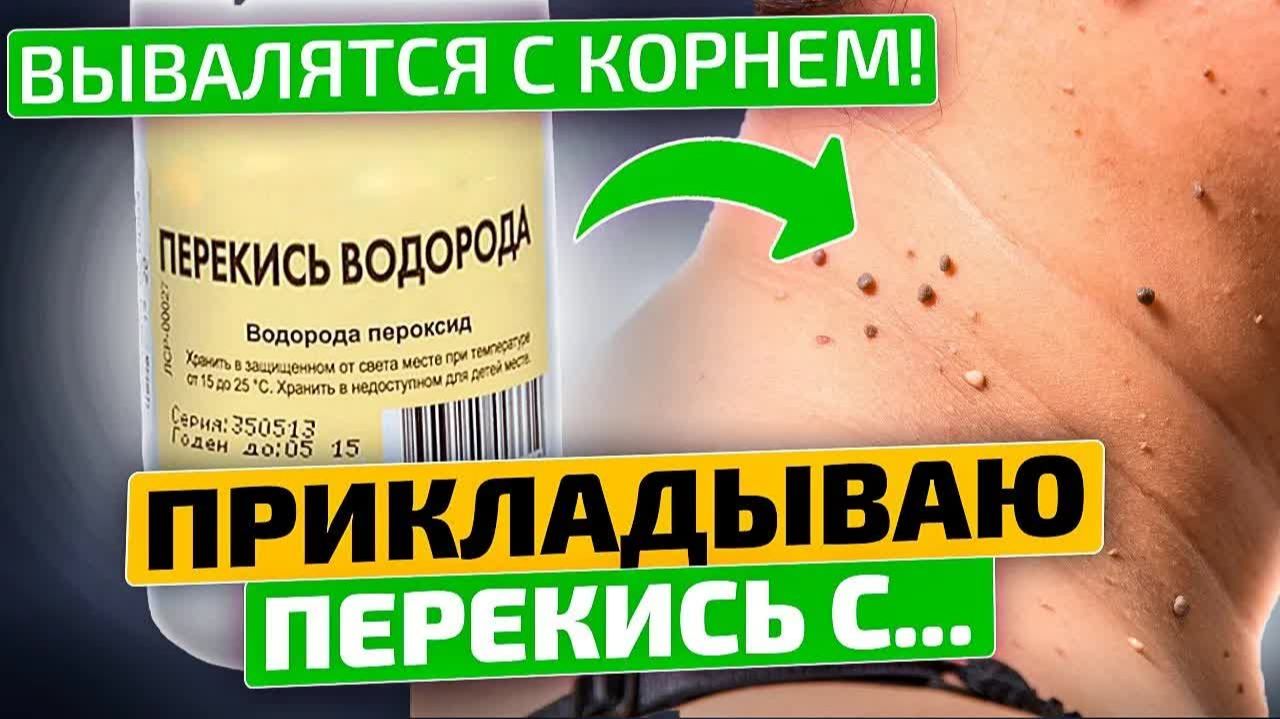 Свекровь избавилась от папиллом 😱 Метод, от которого она засияла!
