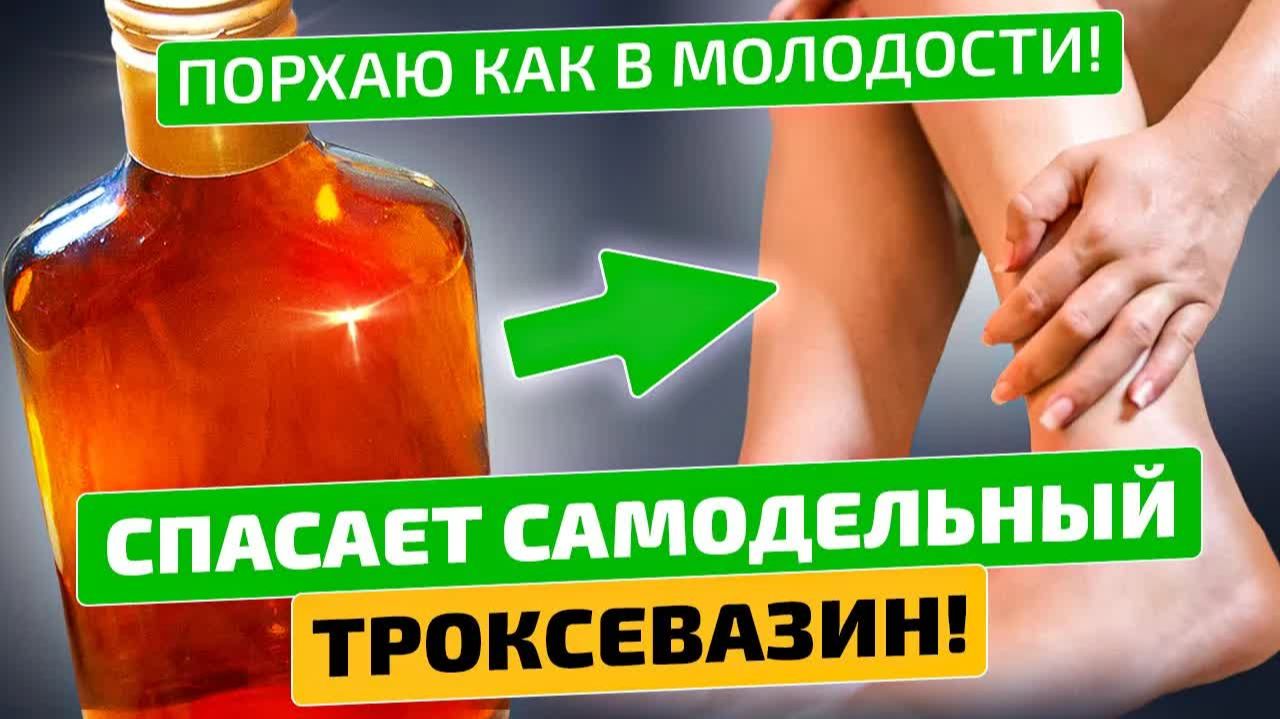 Троксевазин дома 💪 Отеки, боль, тромбы, варикоз и травмы — лечу сам!