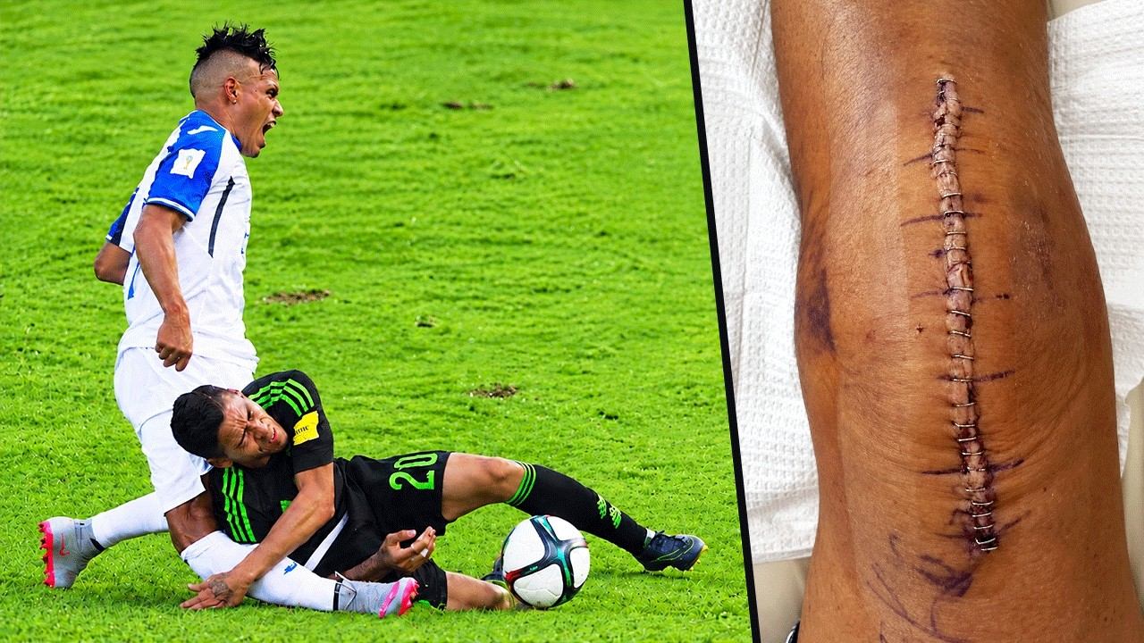 Most Horrific Football Injuries Ever