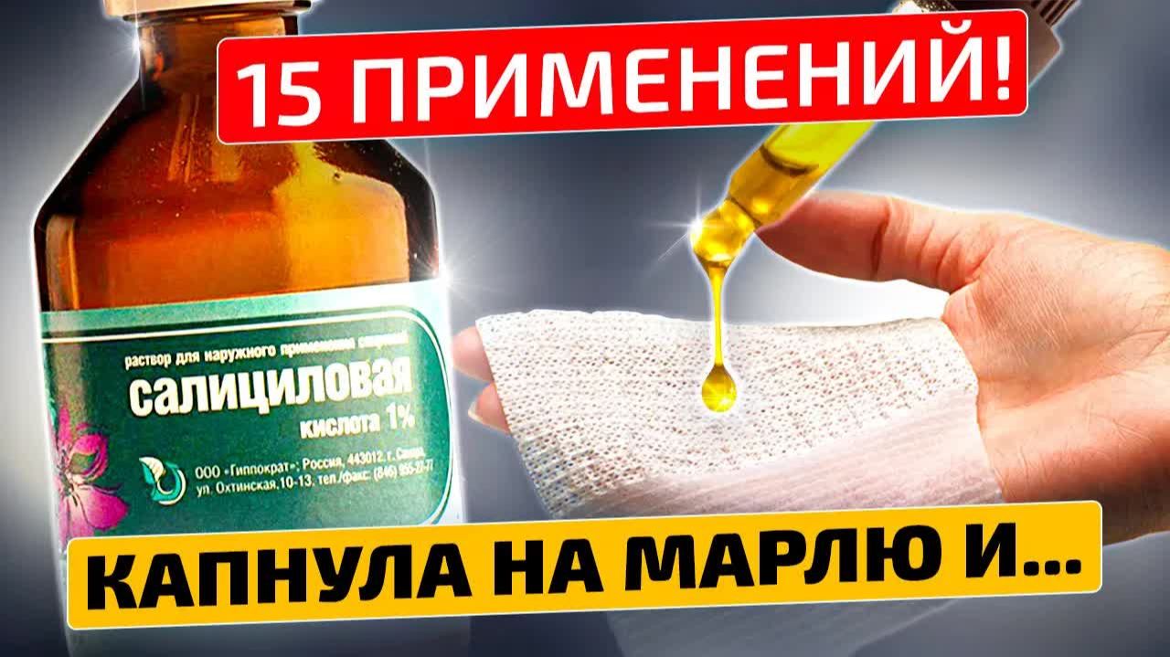 Салициловая кислота спасла меня после долгих мучений 😱🔥