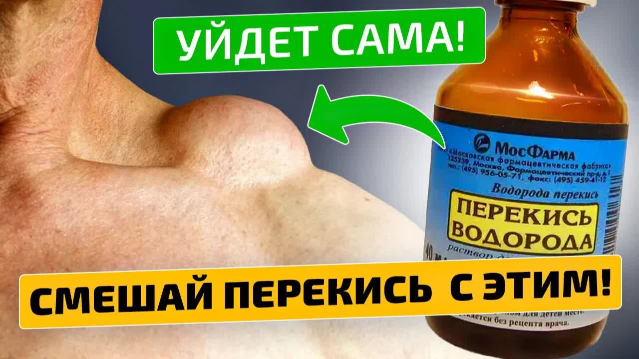 Липома исчезнет без больницы за несколько дней 😱💀