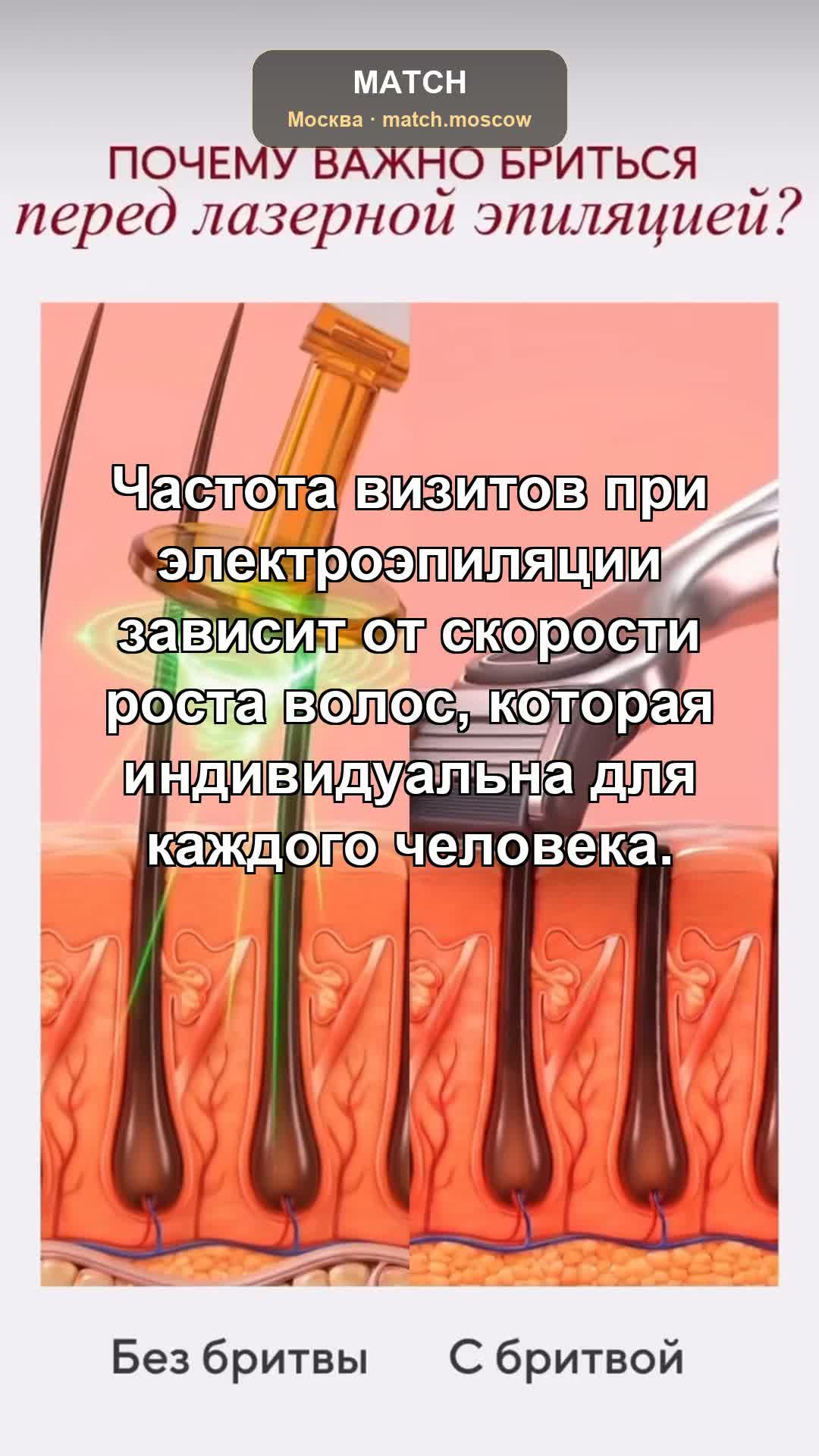 Влияние скорости роста волос на частоту визитов: как рассчитывается интервал между сеансам