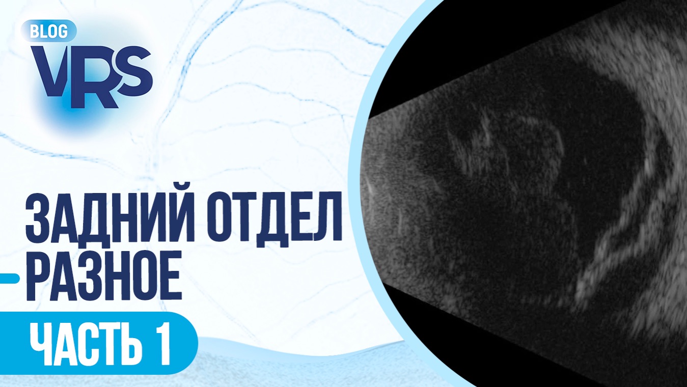Сезон 7