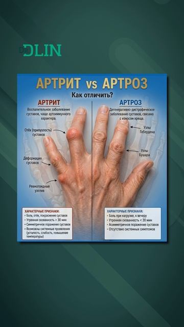 Артрит или артроз?  #здоровье #артрит #артроз