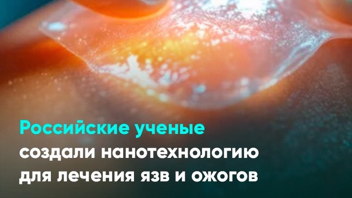 Российские ученые создали нанотехнологию для лечения язв и ожогов