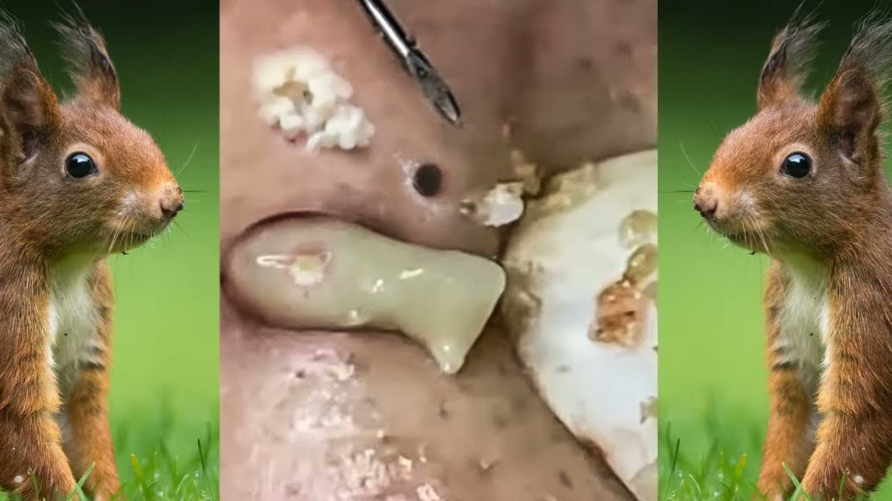 Relax Squeezing Out Blackheads #55 Черные точки
